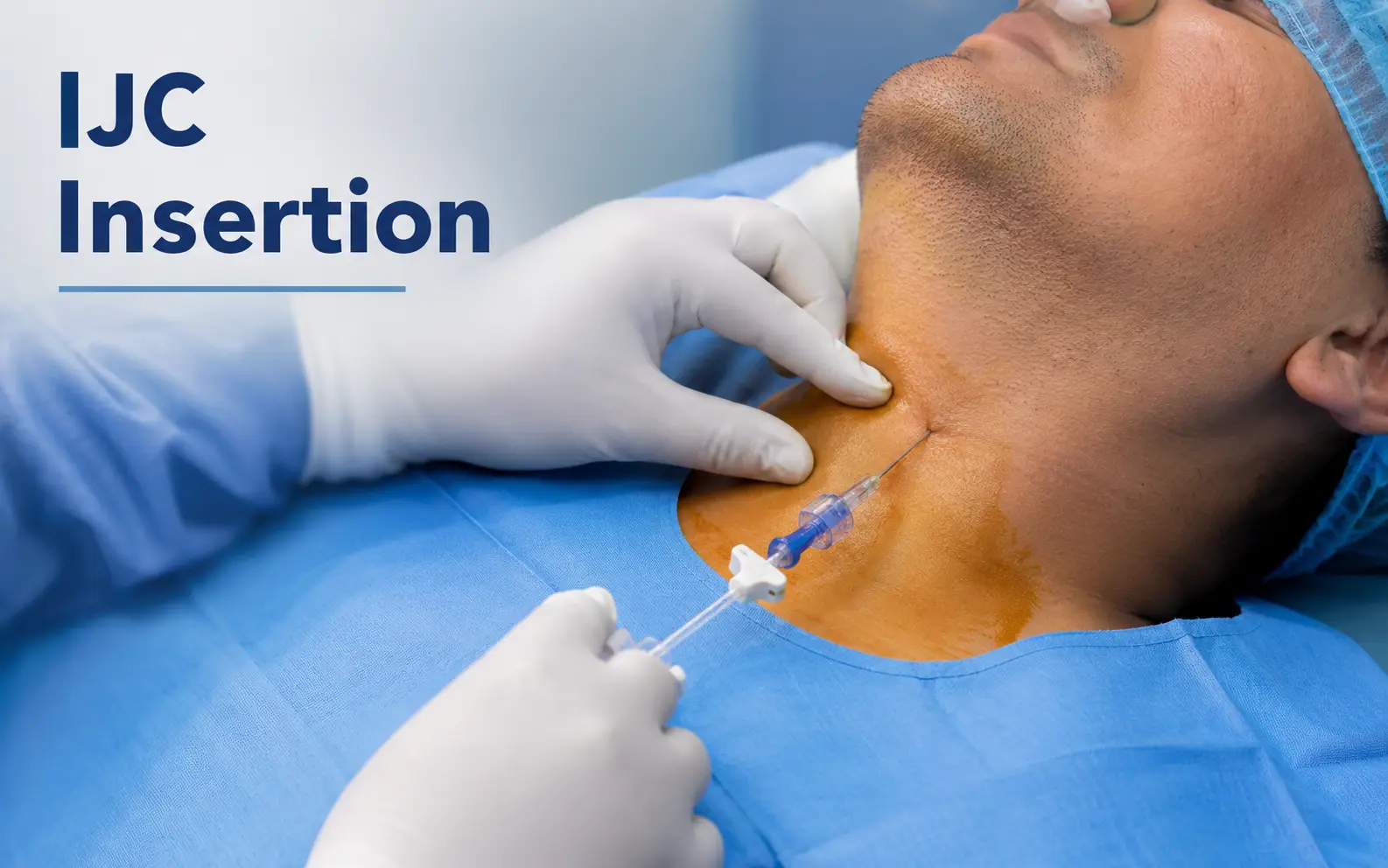 IJC Insertion